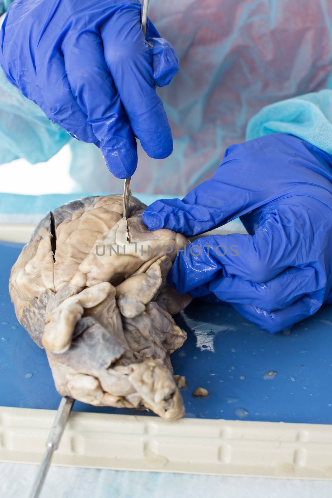 Medical student studying the structure of a preserved sheep heart dissecting it with a scalpel cutting into the muscle of the wall of a ventricle, closeup view of the hands