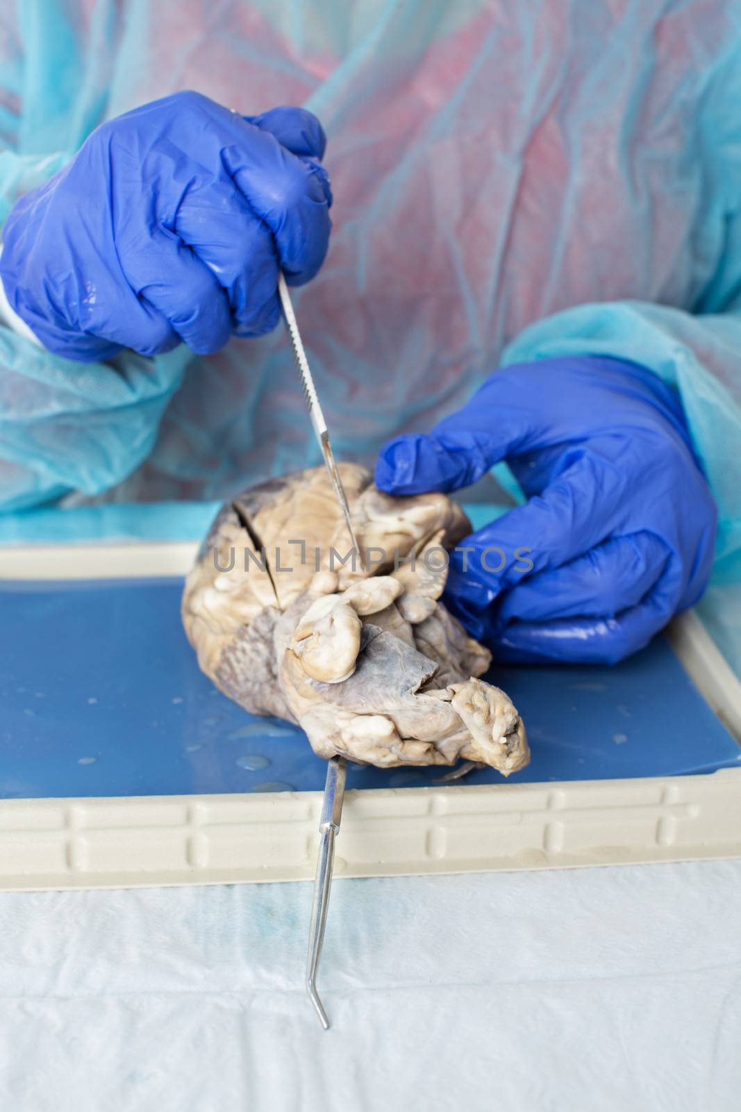Medical student dissecting a sheep heart by coskun