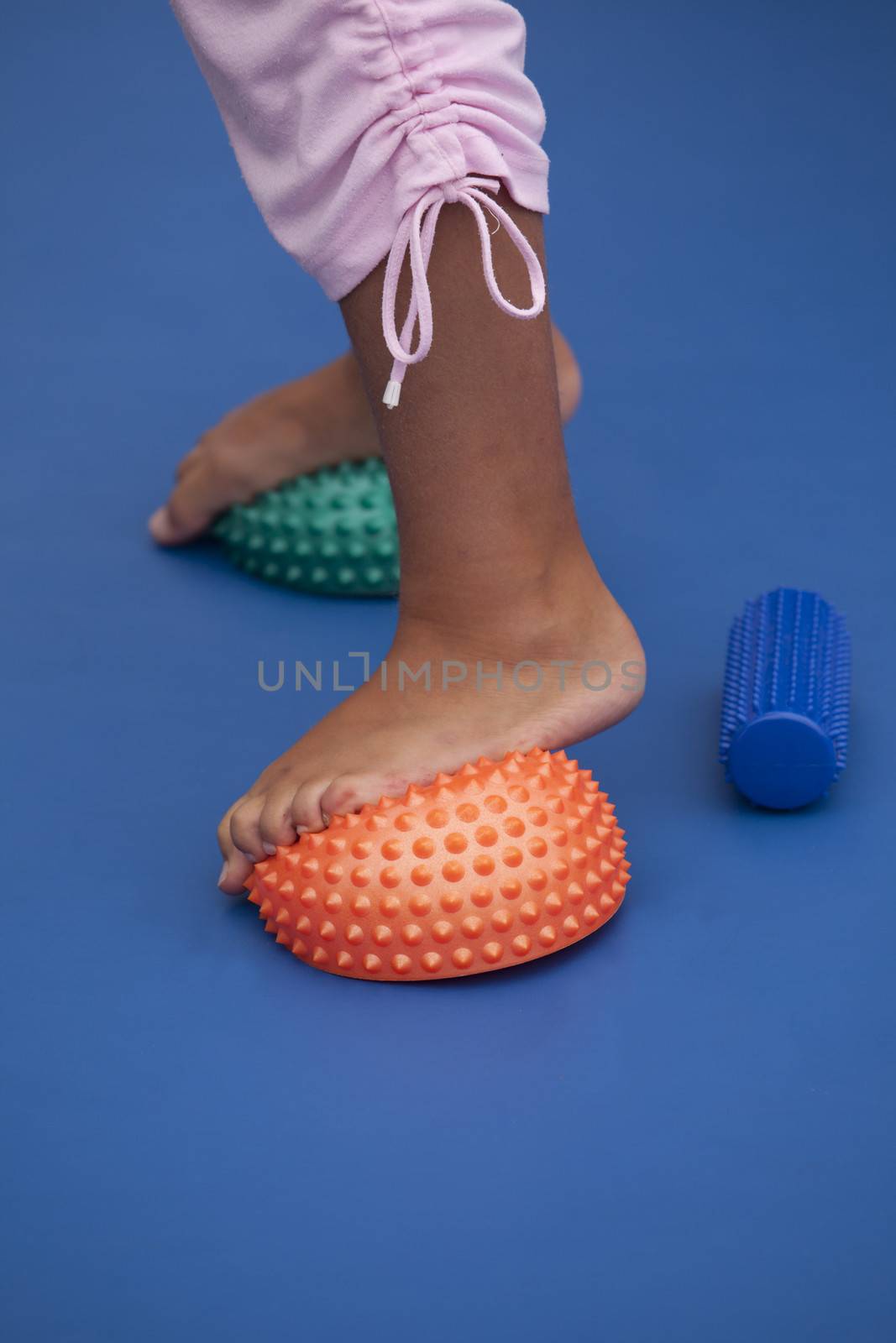 Flat feet treatment for children