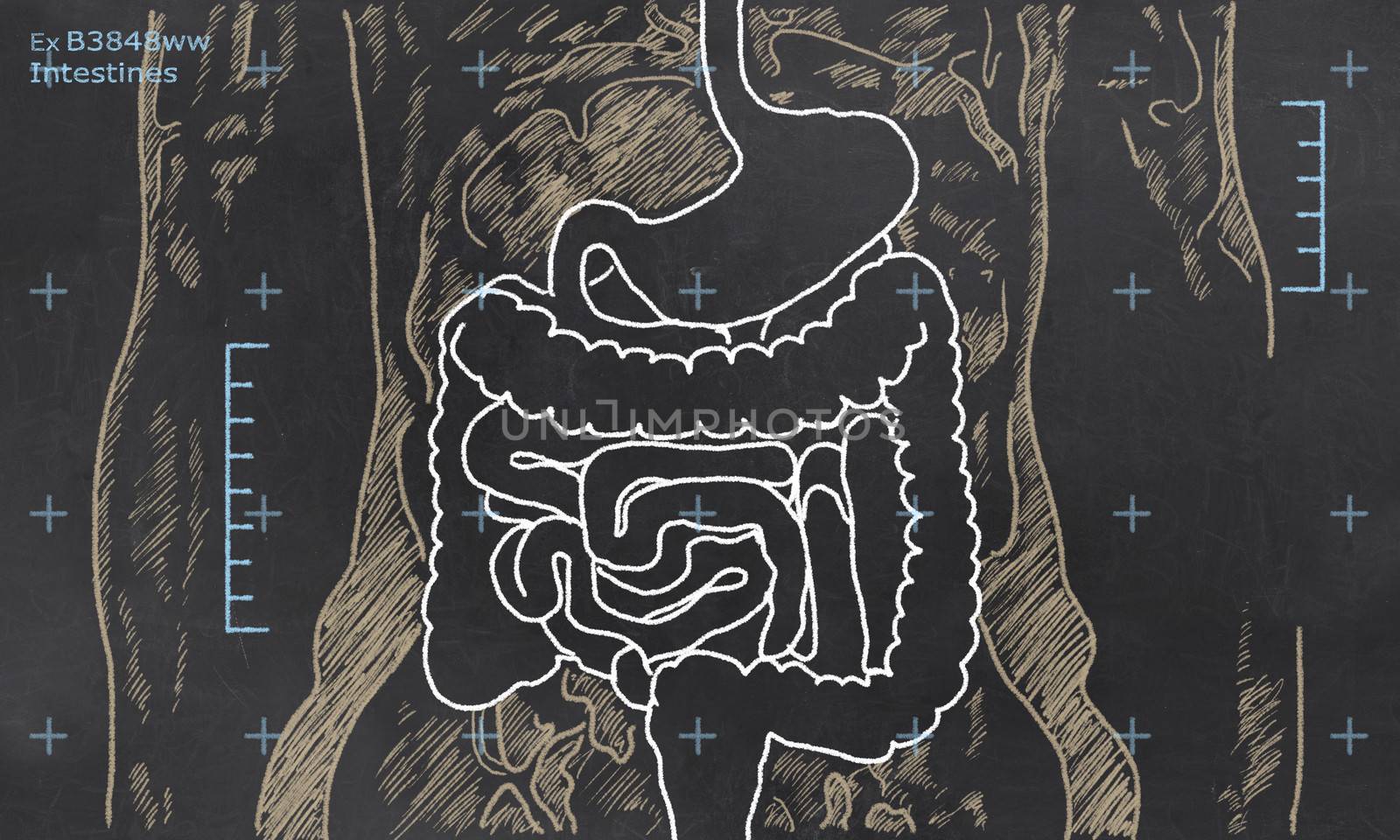 X-ray of Intestines sketched on a Blackboard