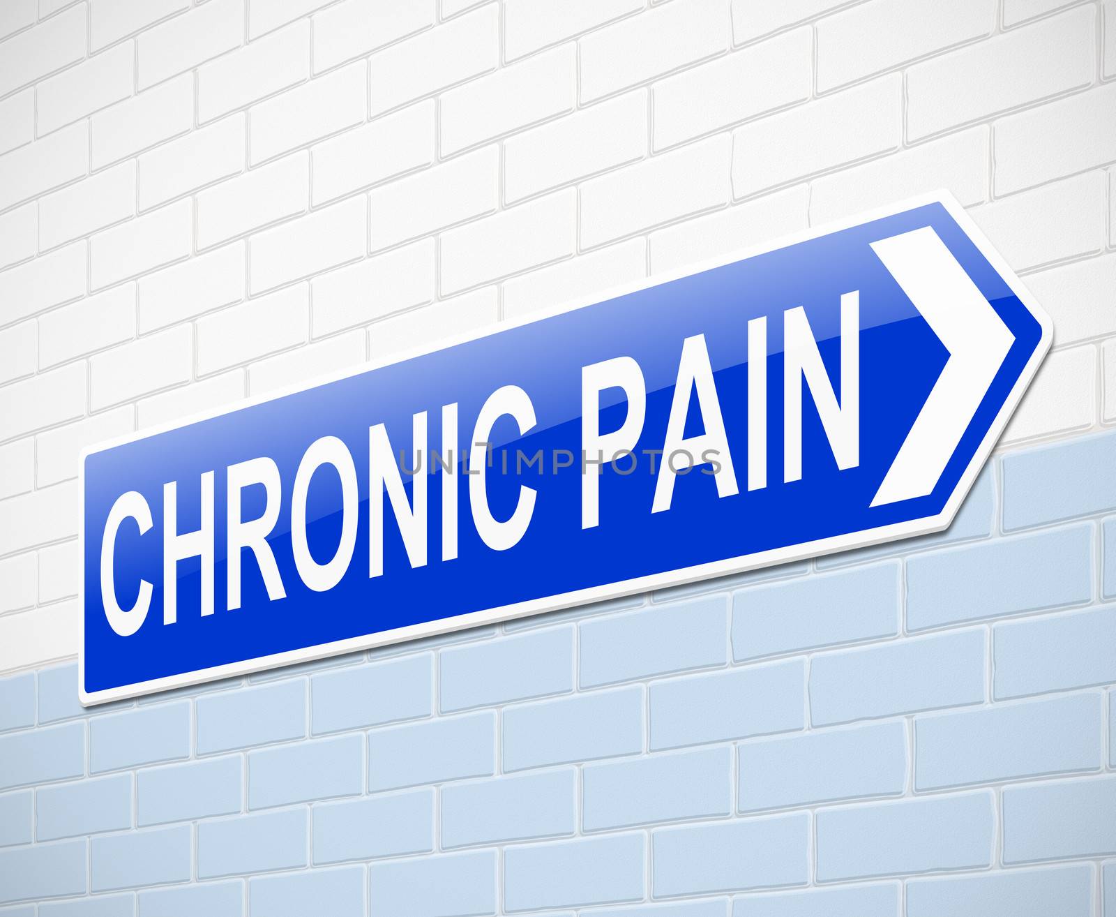 Illustration depicting a sign with a chronic pain concept.