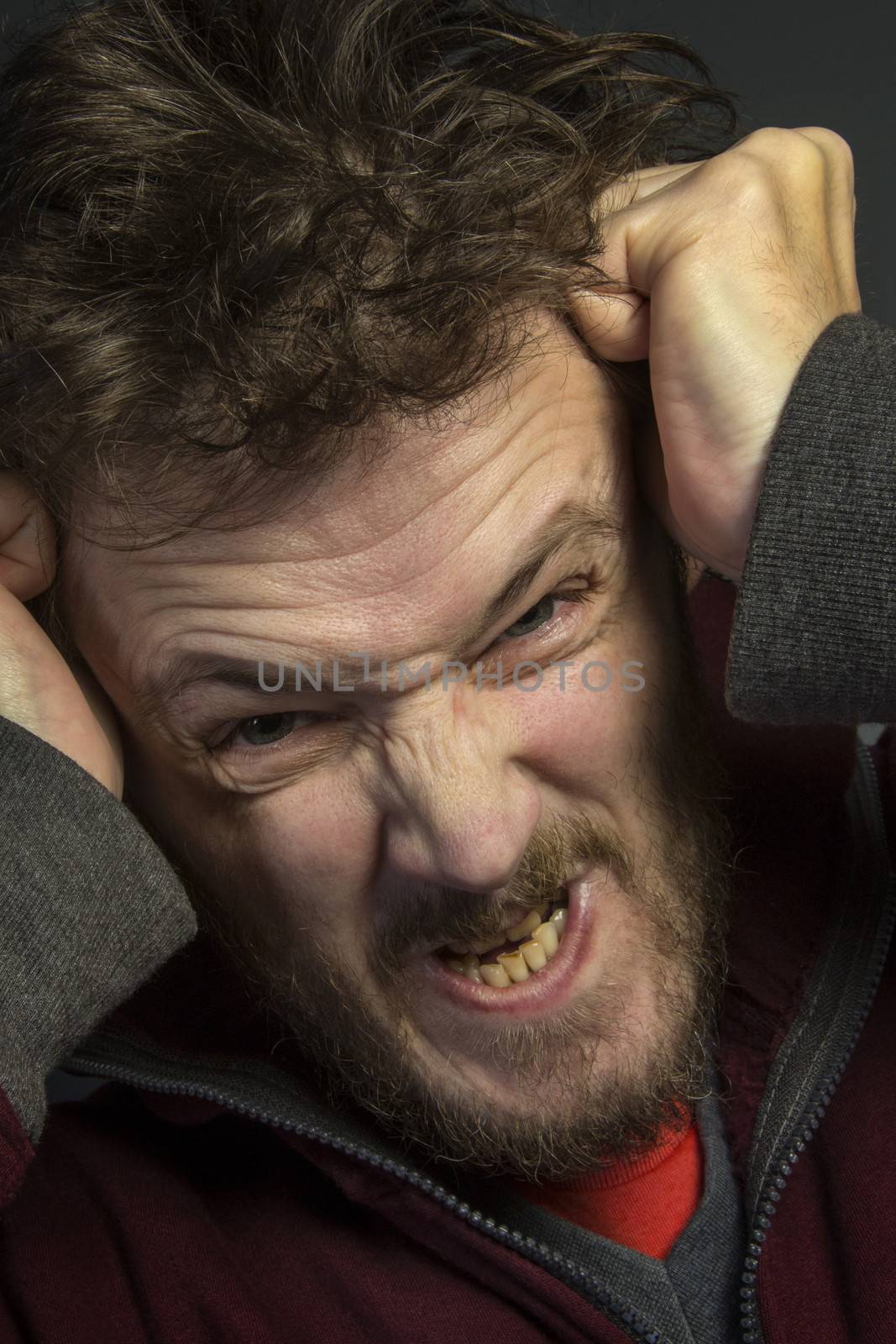 An angry man with a bad temper tearing his hair out.