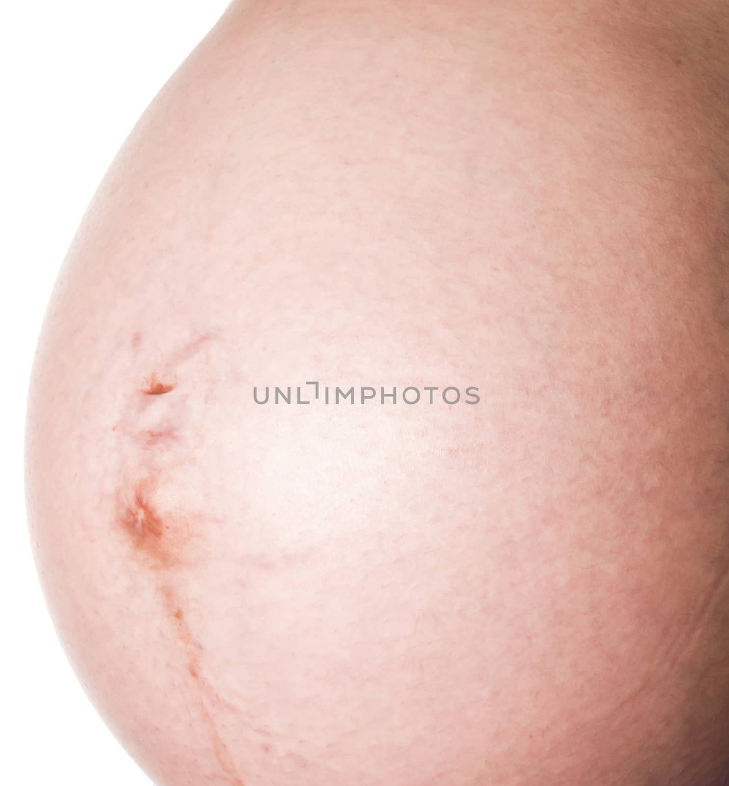 Huge pregnant belly isolated towards white background