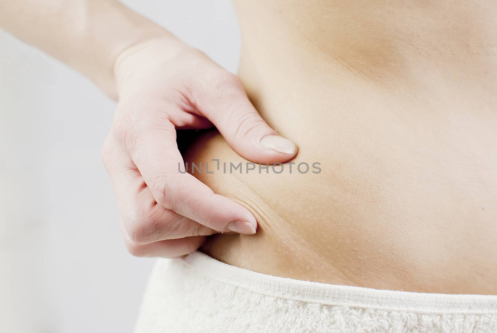 young woman holding her skin for cellulite check