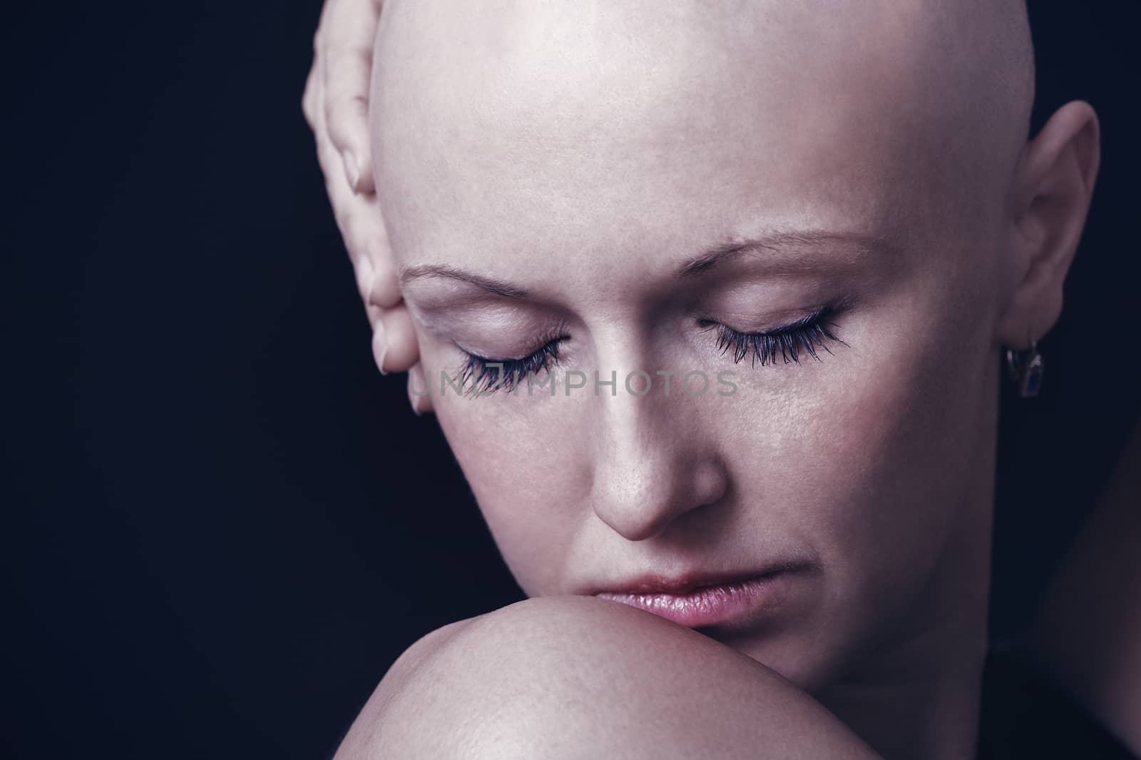 Portrait of a young bald-headed girl in studio