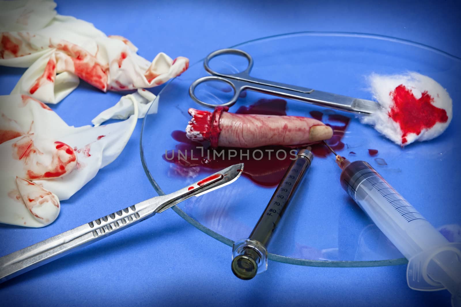 transplant of index finger, instruments during a surgical procedure