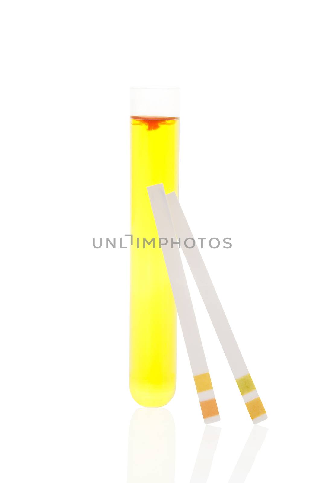 Urine in test tube and pH test strips. by eskymaks