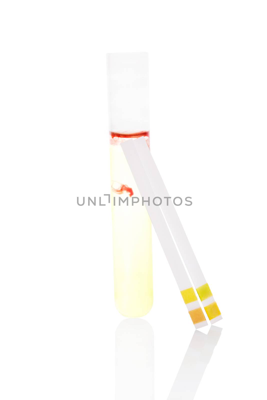 Urine sample with blood. by eskymaks