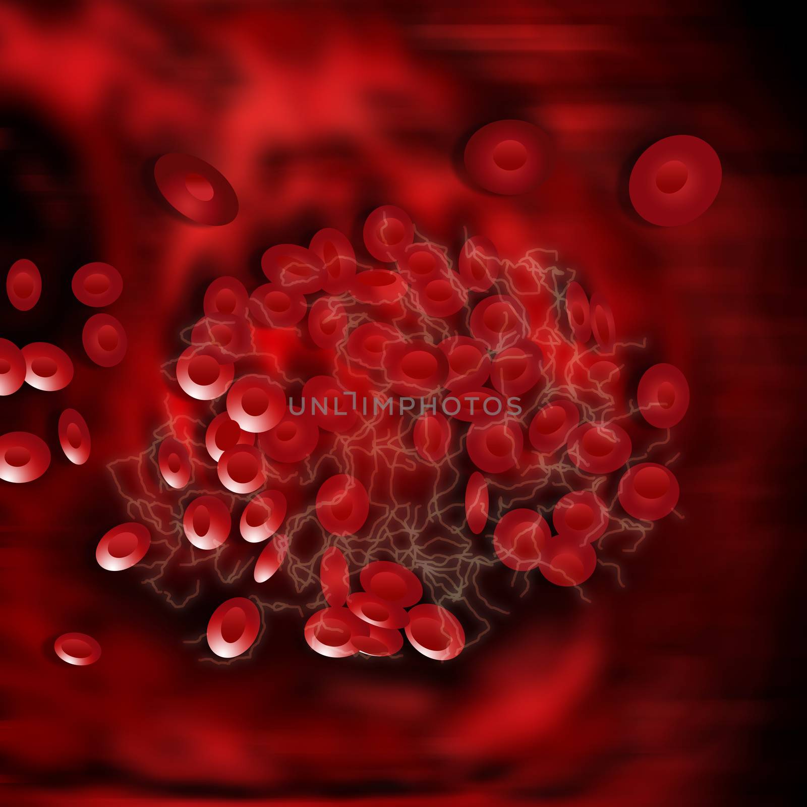 Illustration of Blood Clot. Red blood cells are red and fibrin protein strands are off-white in color.