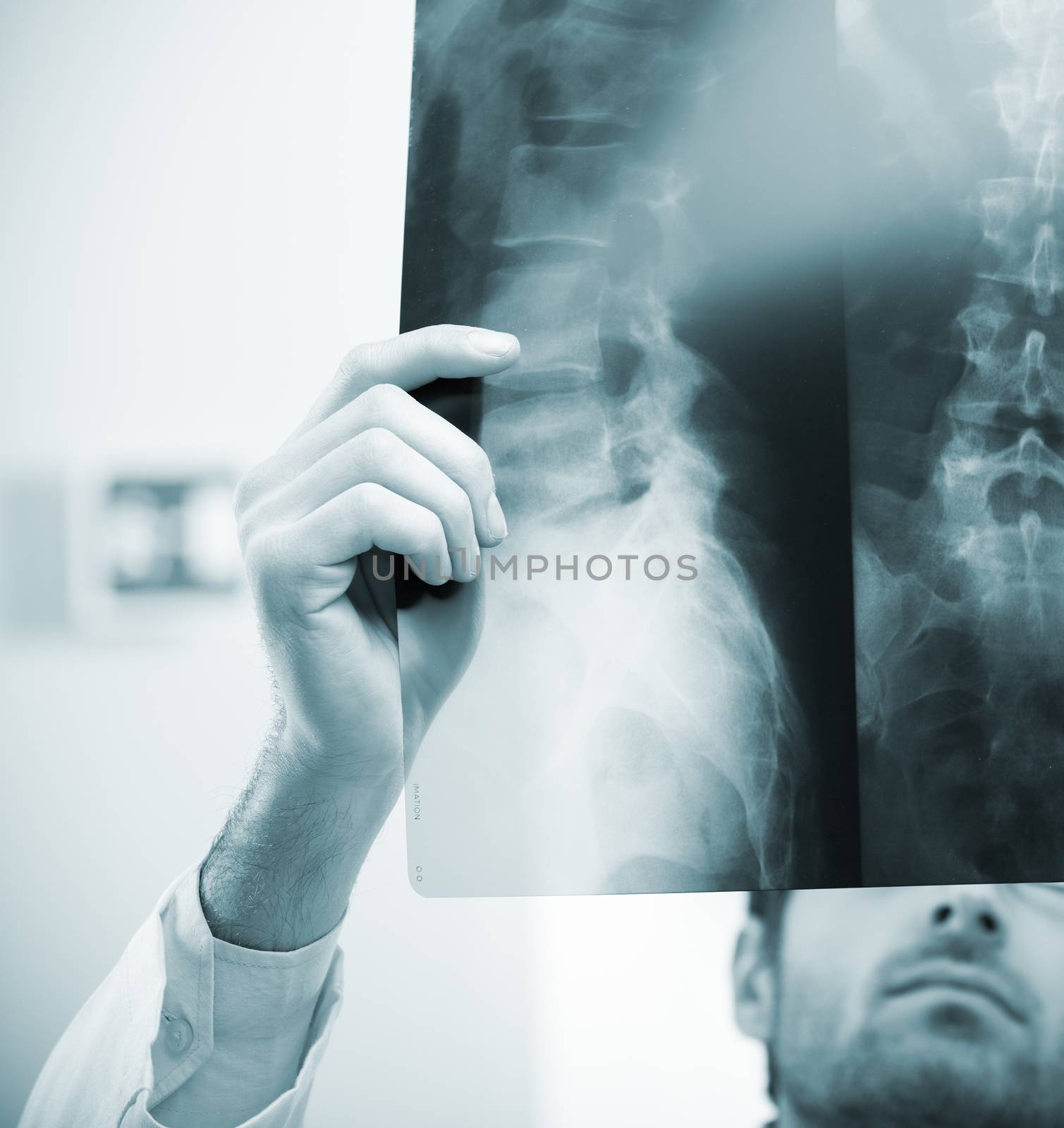 Professional radiologist examining an X-ray image of human spine.