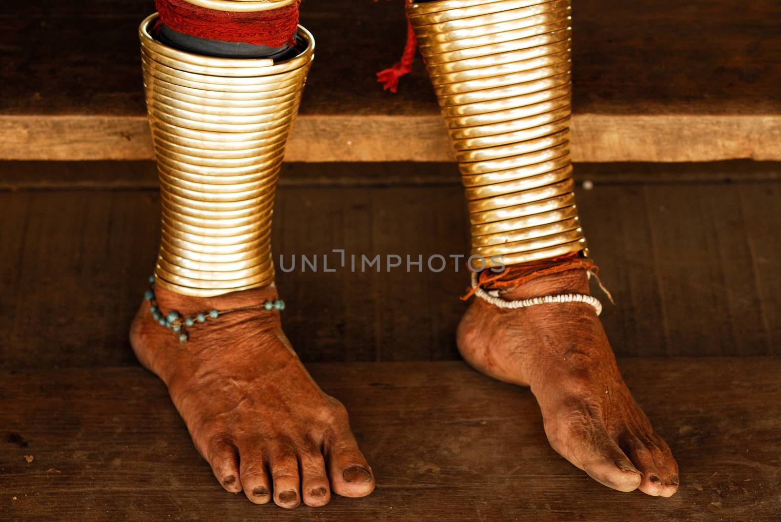 feet of Long Necked Karen hiltribe Woman by think4photop