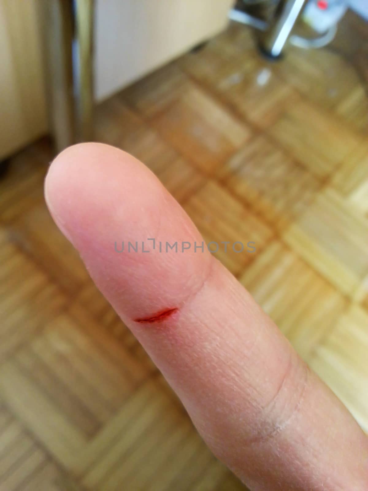 Small cut wound on a human finger
