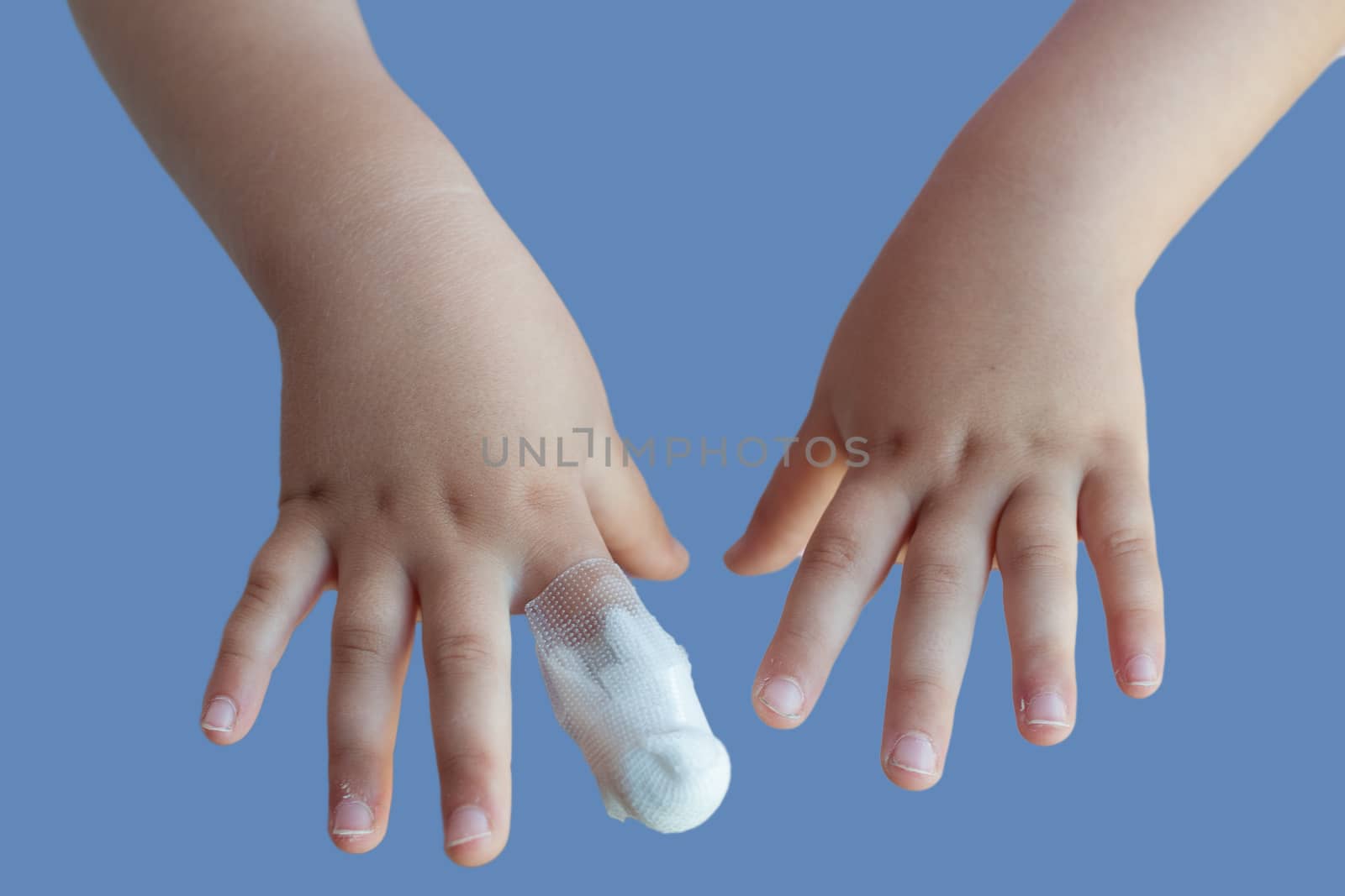 Two hands of a little children with a injured finger