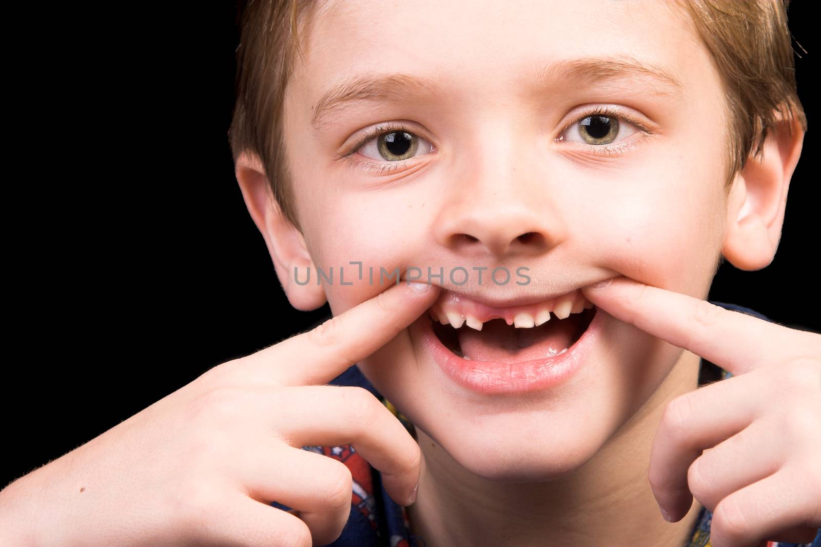 Young boy with beautiful green eyes who has one tooth missing