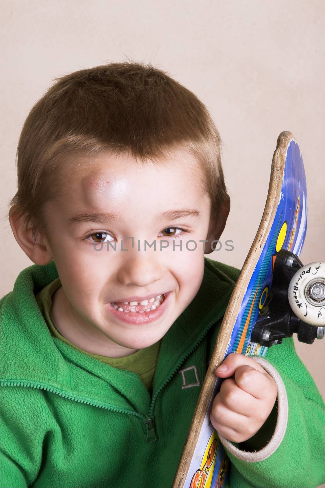 Young boy with a bump on his head after falling