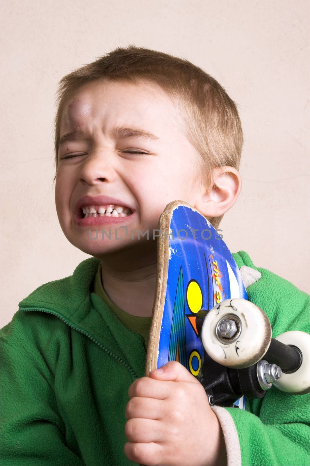 Young boy with a bump on his head after falling