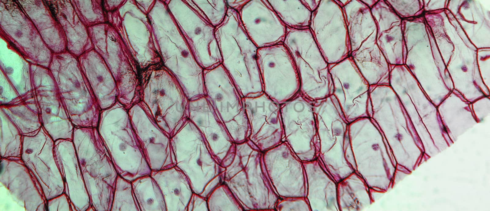 Onion epidermus micrograph by claudiodivizia