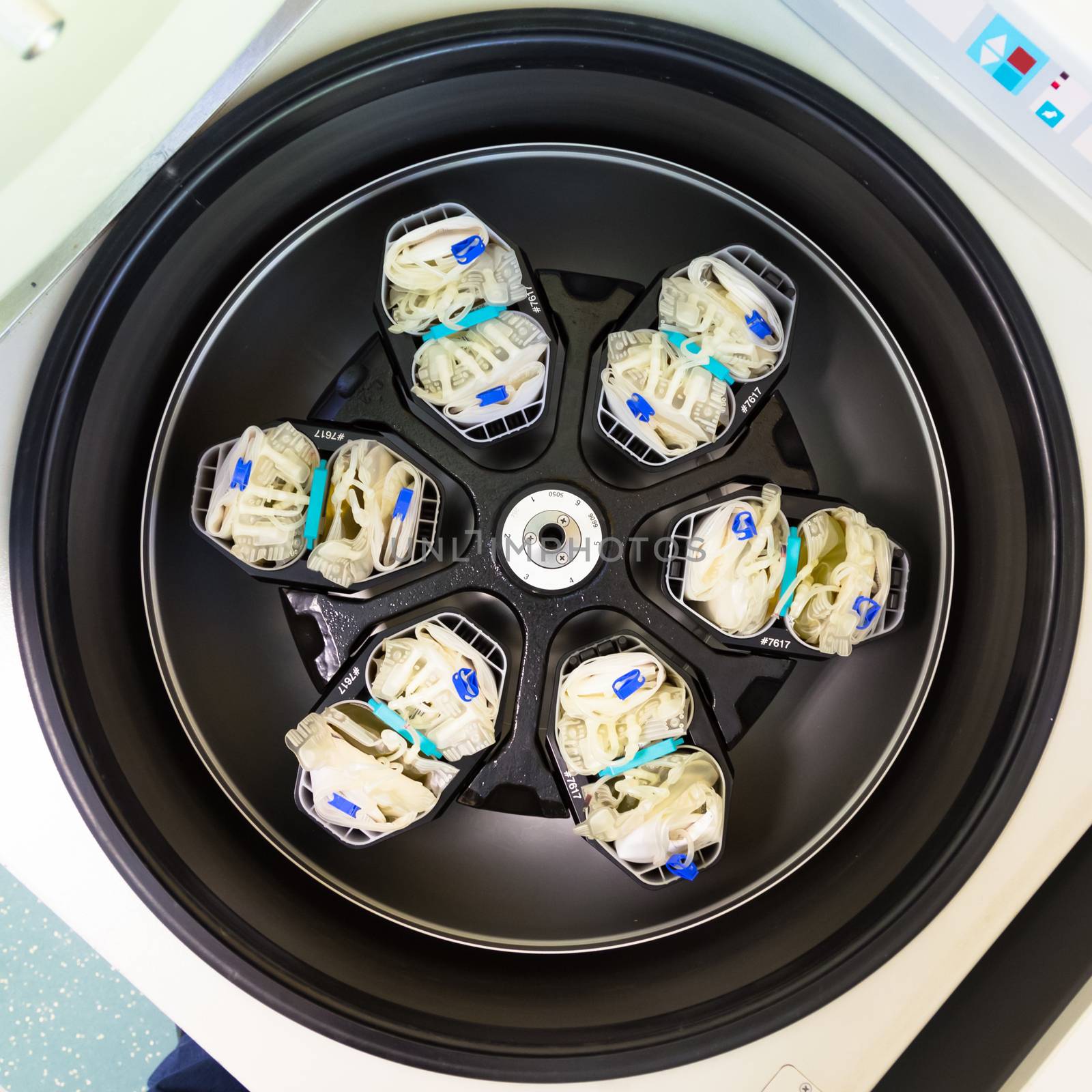 Blood bags after blood donation in centrifuge for separation of serum and red blood cells.