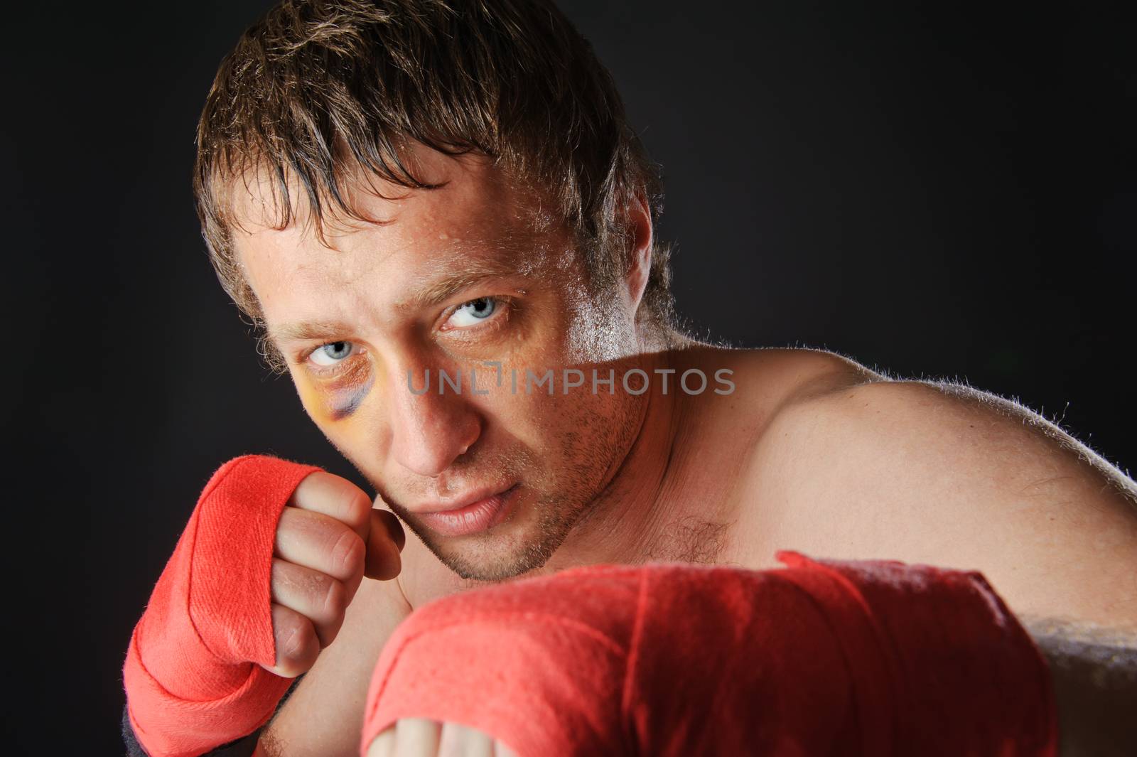 Portrait of a man with a black eye in a battle position. Clenched fists. Dark background.