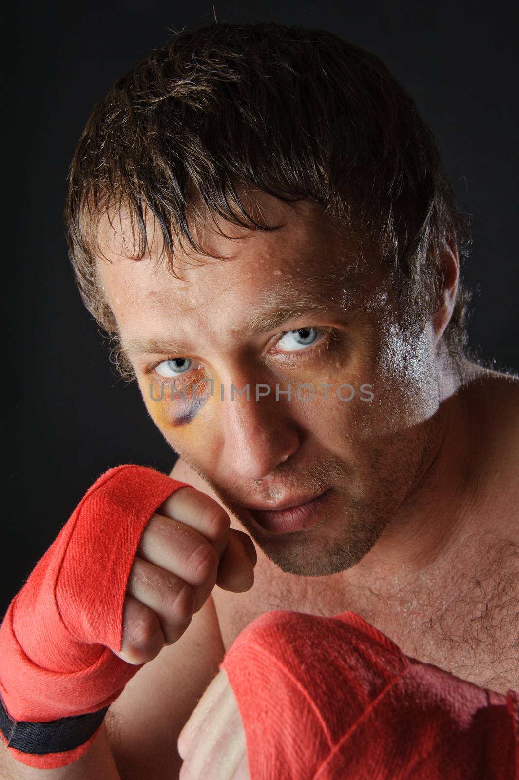 Portrait of a man with a black eye in a battle position. Clenched fists. Dark background.