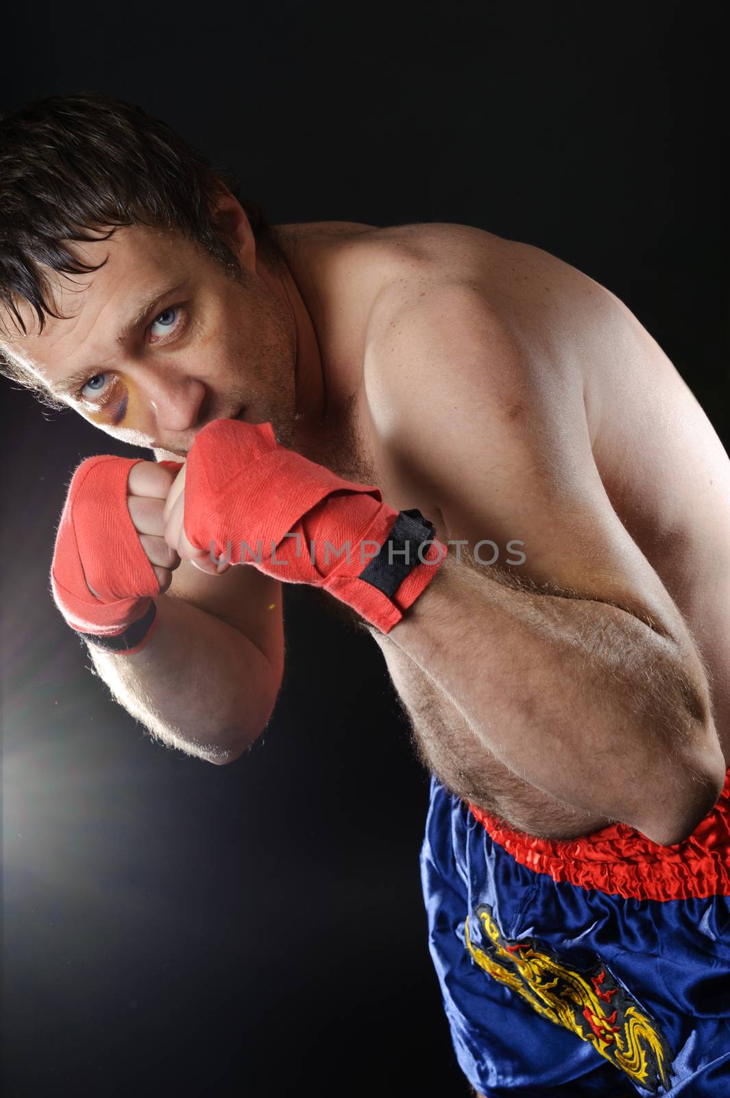 Boxer with a bruise in a battle position. Clenched fists. Dark background.