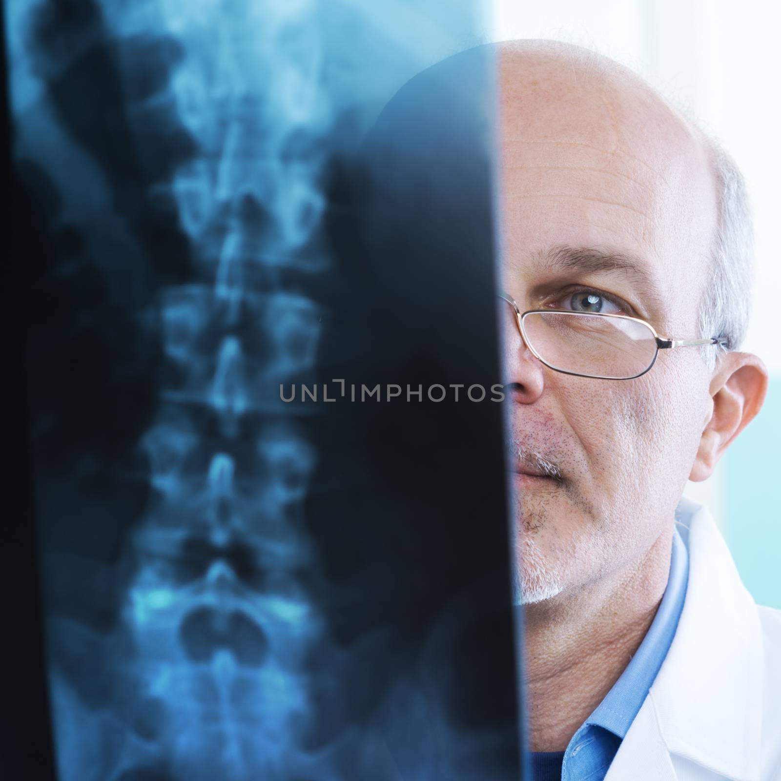 Male senior doctor looking at x-ray images of human spine.