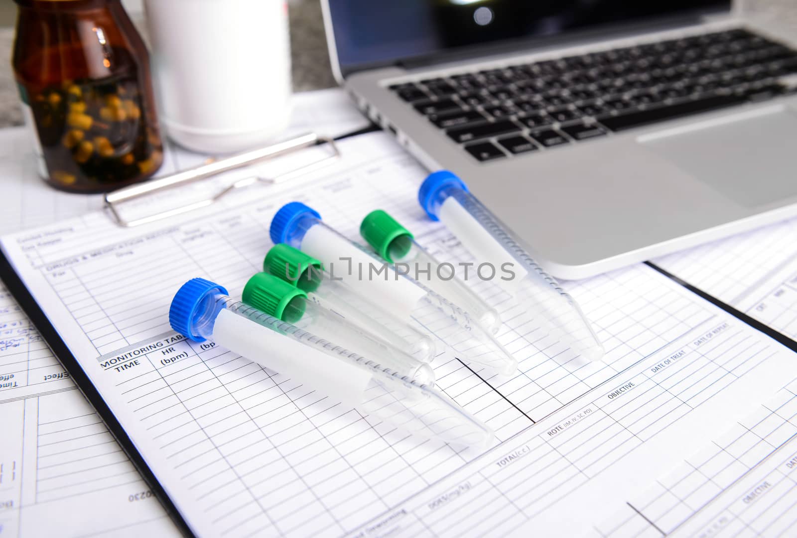 sample tube with labtop  and other medical object on the table