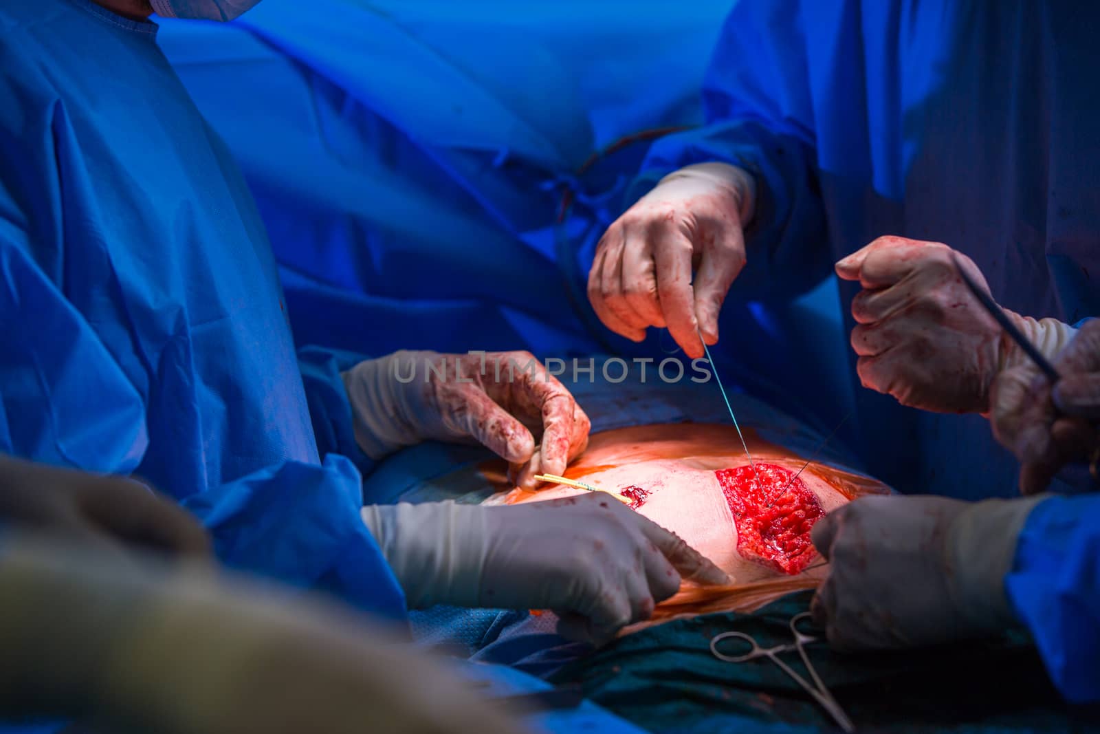 Surgery in a modern hospital by viktor_cap