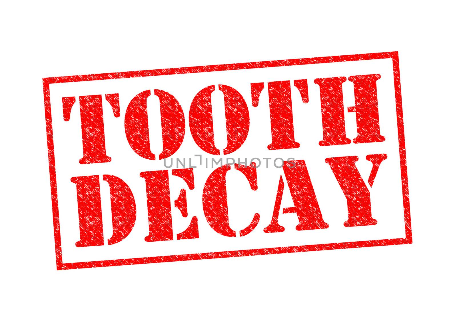 TOOTH DECAY red Rubber Stamp over a white background.