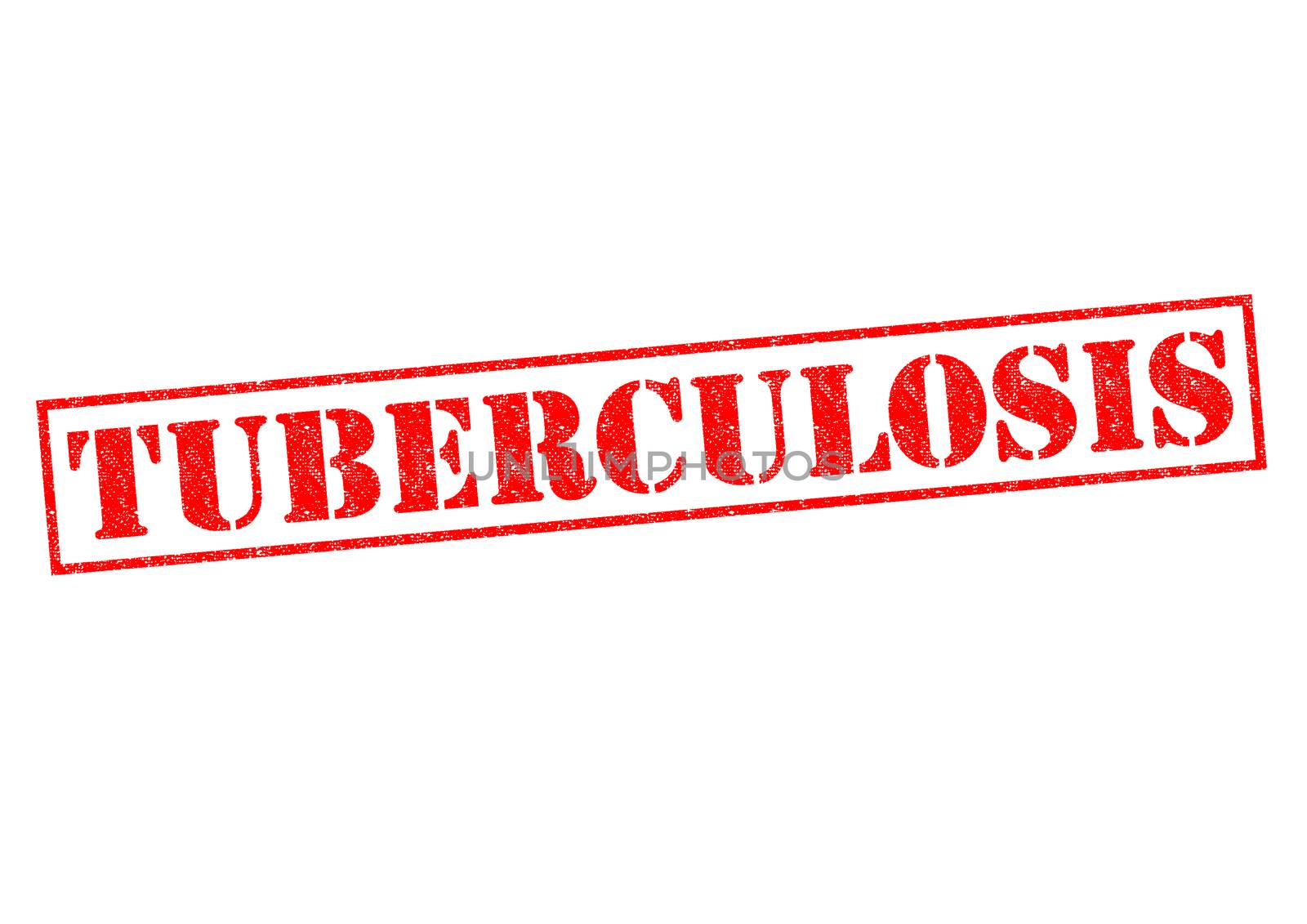 TUBERCULOSIS red Rubber Stamp over a white background.