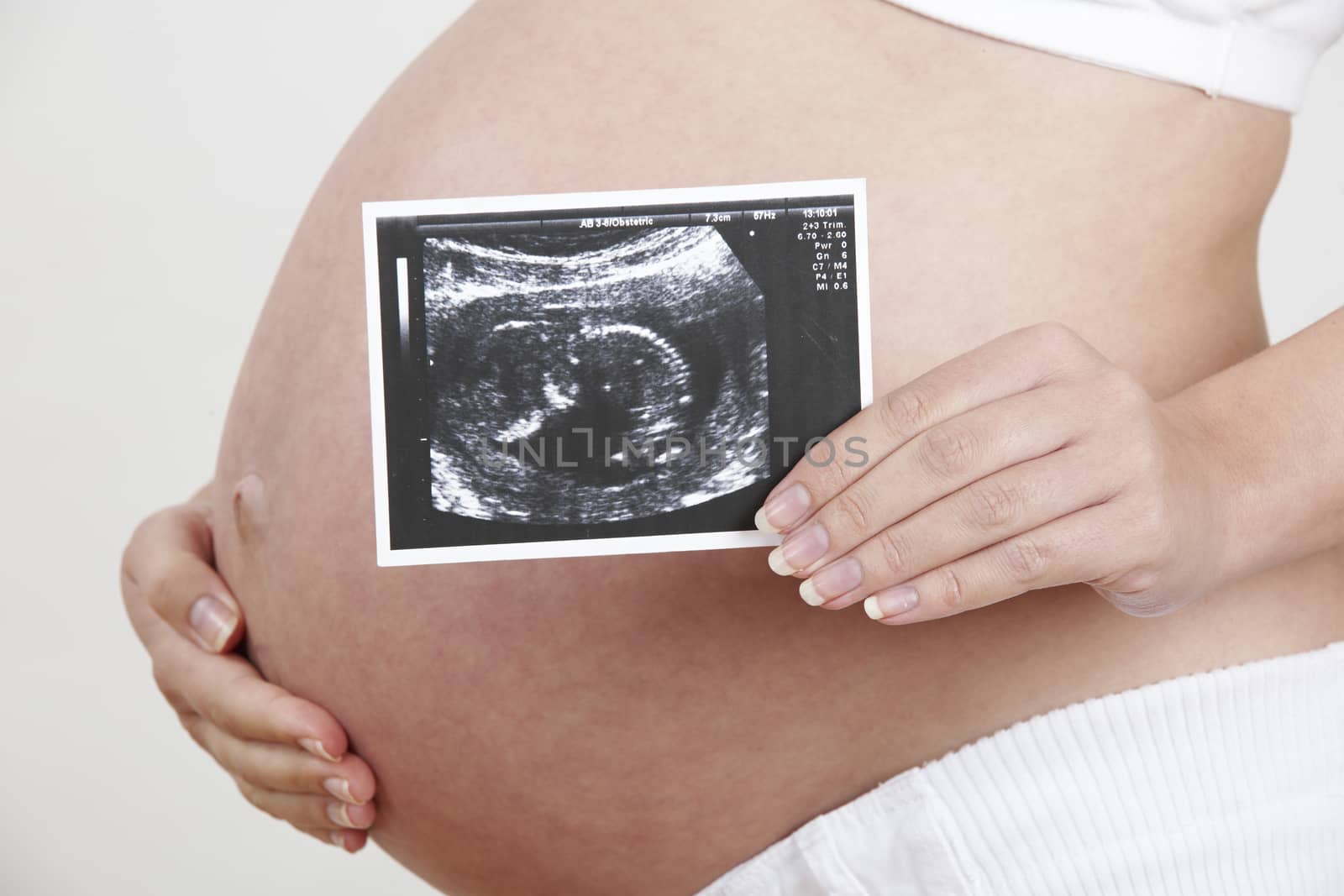 Close Up Of Pregnant Woman Holding Baby Scan by HighwayStarz