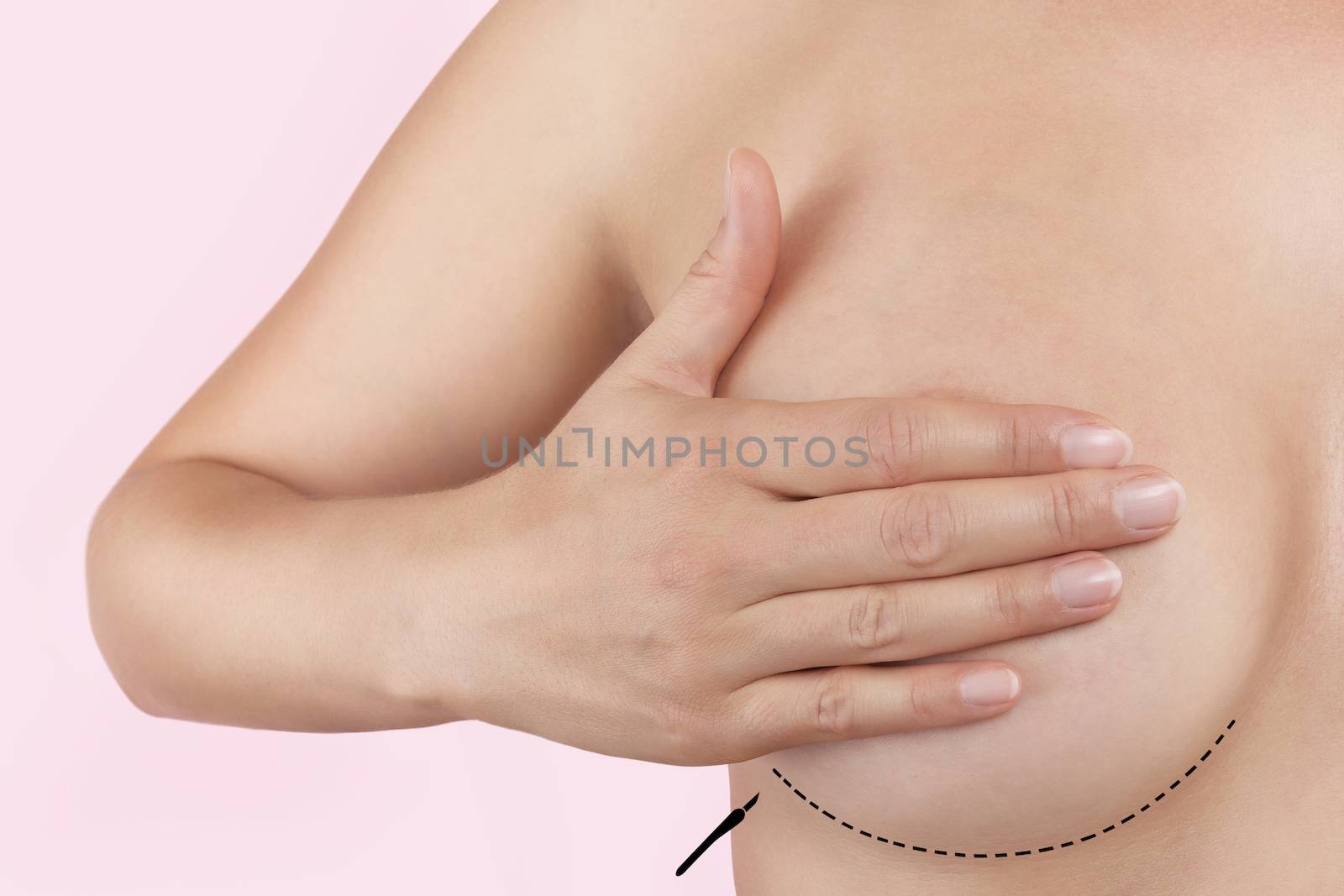 Aesthetic medicine and plastic surgery. Female hand covering breast with dotted outline isolated on pink background. Beauty and Perfection.
