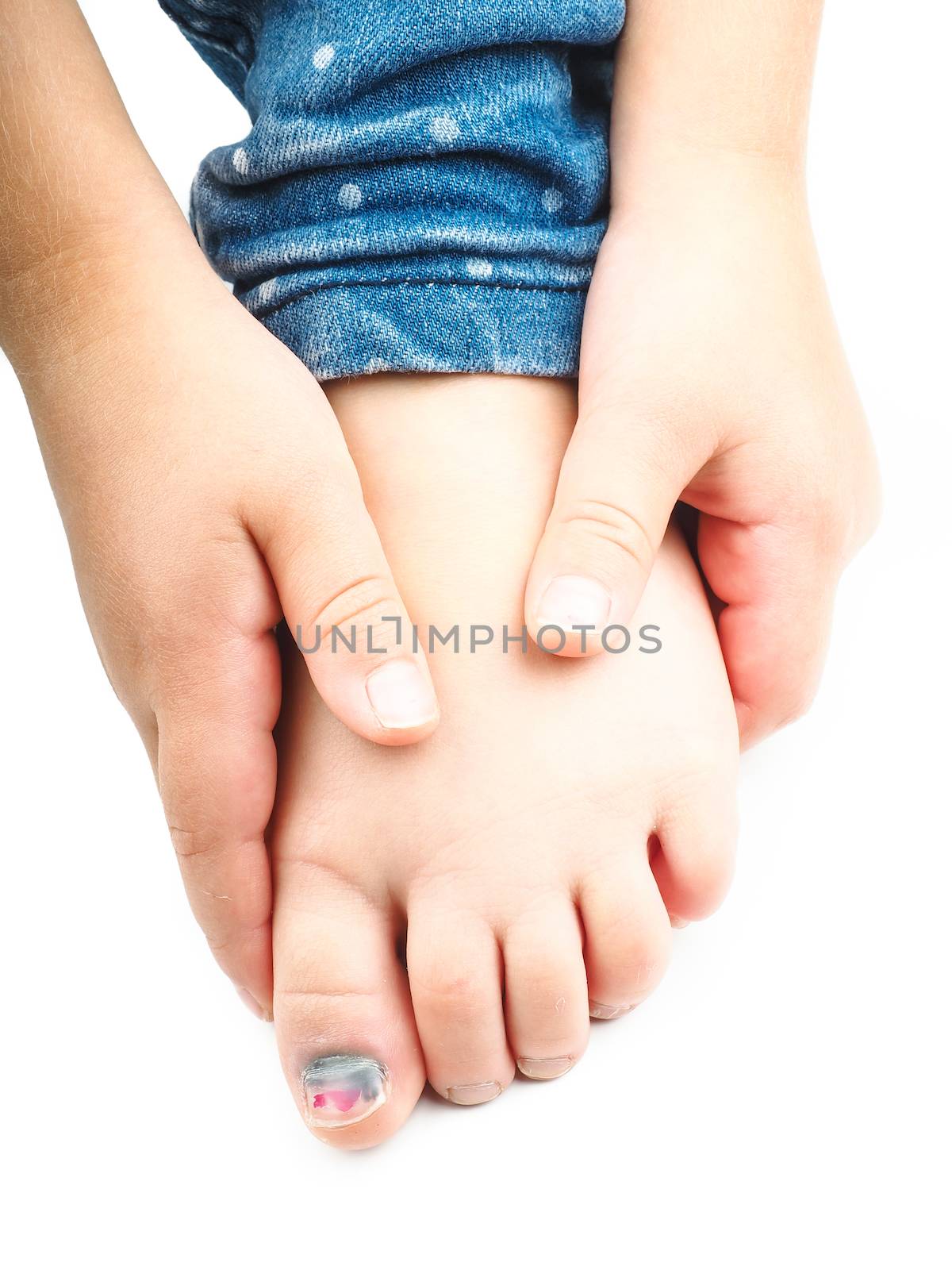 Girl holding onto her foot with a blue nail on the big toe after injury