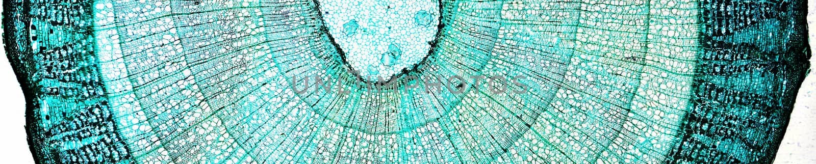 Pine Wood micrograph by claudiodivizia