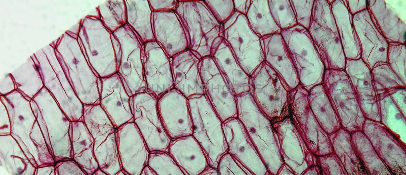 Onion epidermus micrograph by claudiodivizia