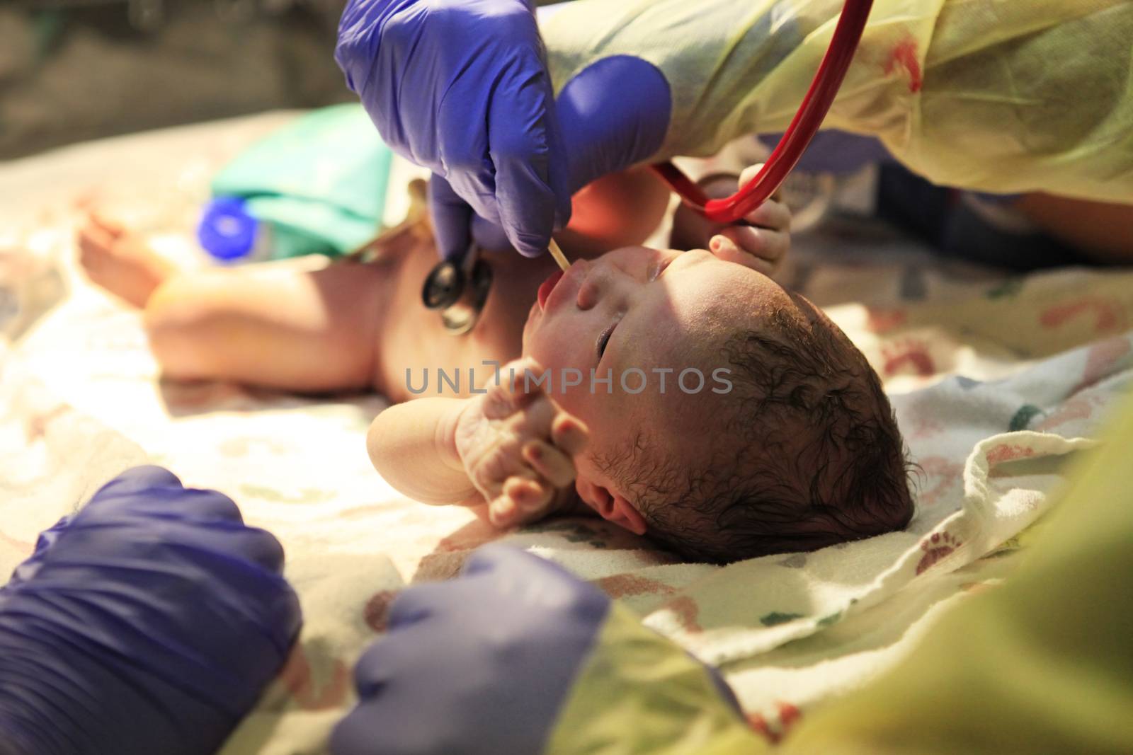 The first minutes of life of the newborn girl