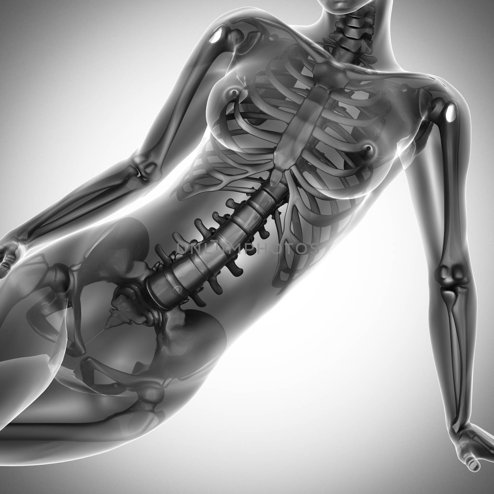 woman  radiography scan on white