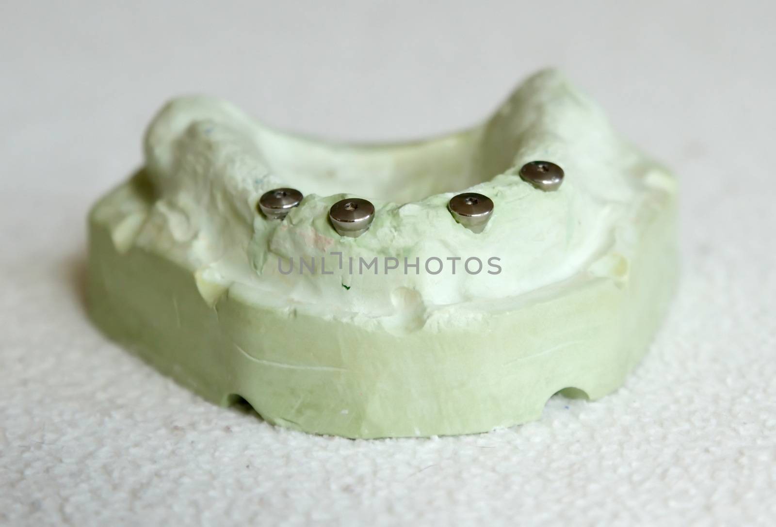 Cast model with four implant preparations by Elenaphotos21