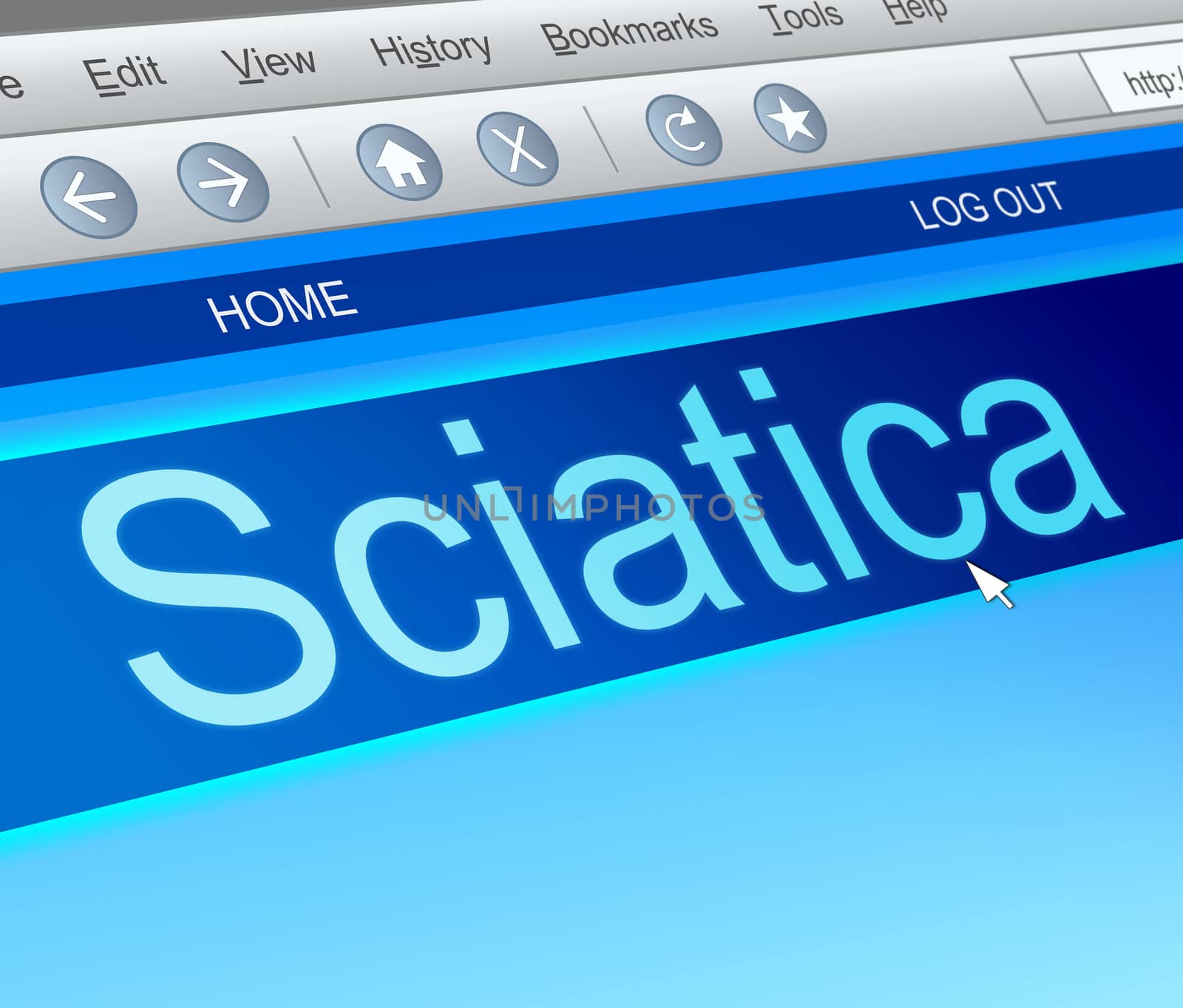 Illustration depicting a computer screen capture with a sciatica concept.