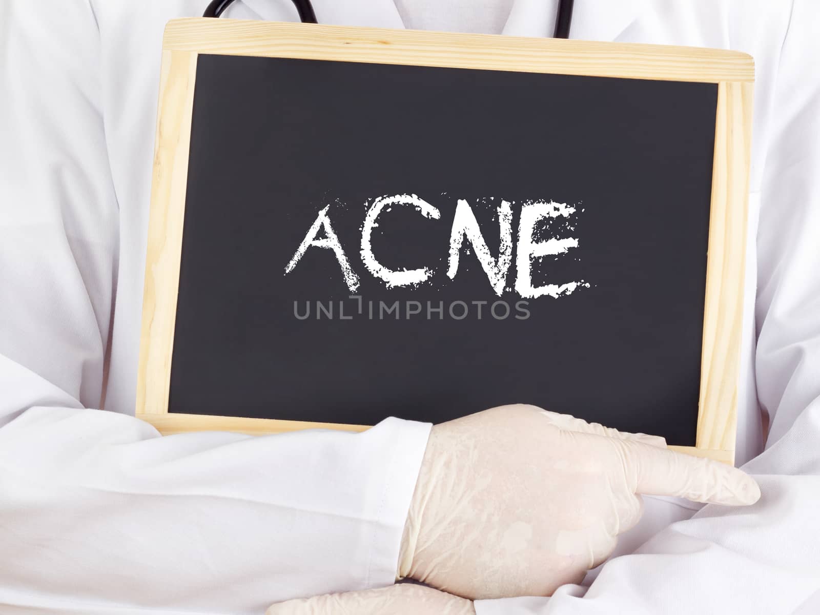 Doctor shows information on blackboard: acne by gwolters