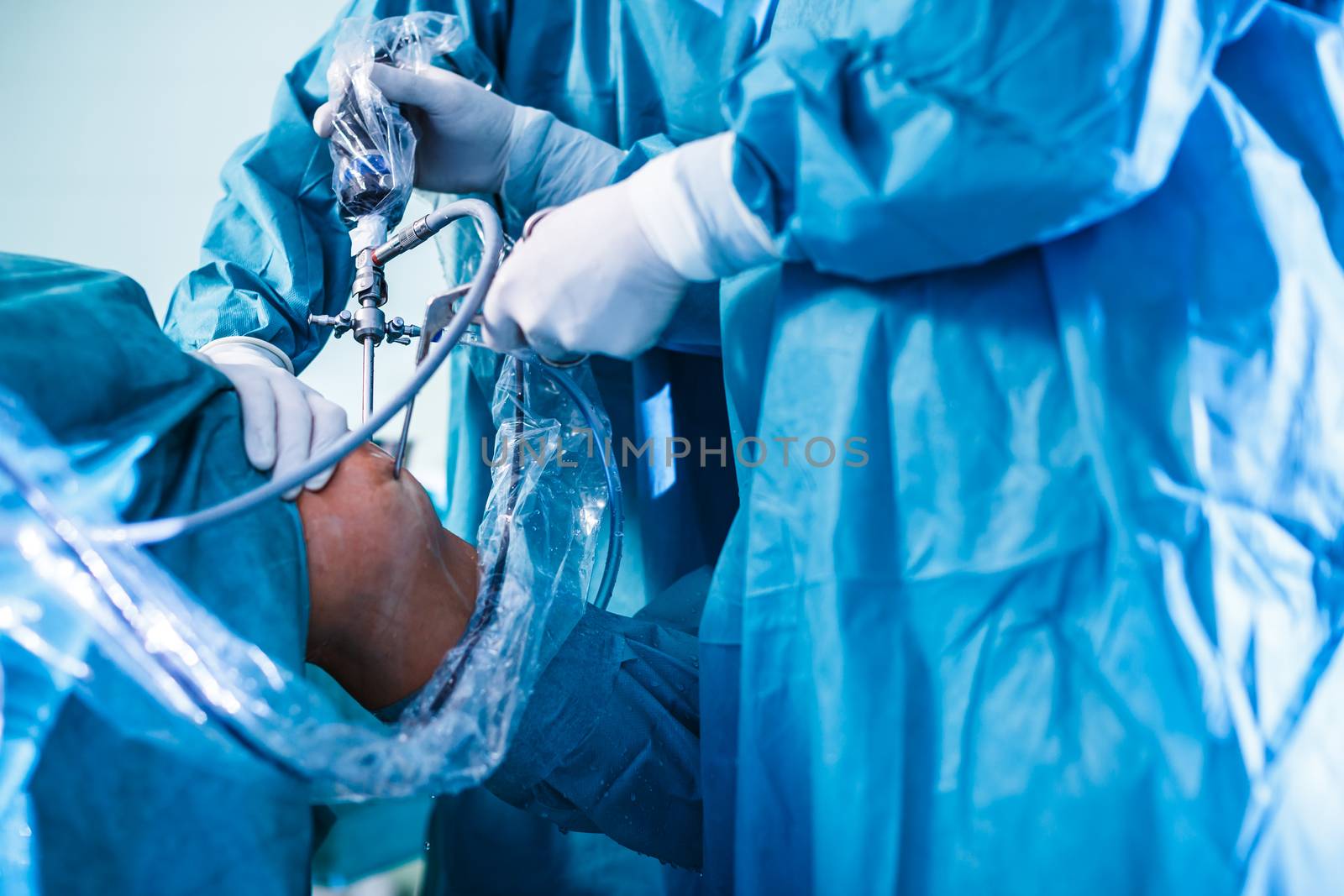 Knee surgery, Orthopedic Operation by viktor_cap