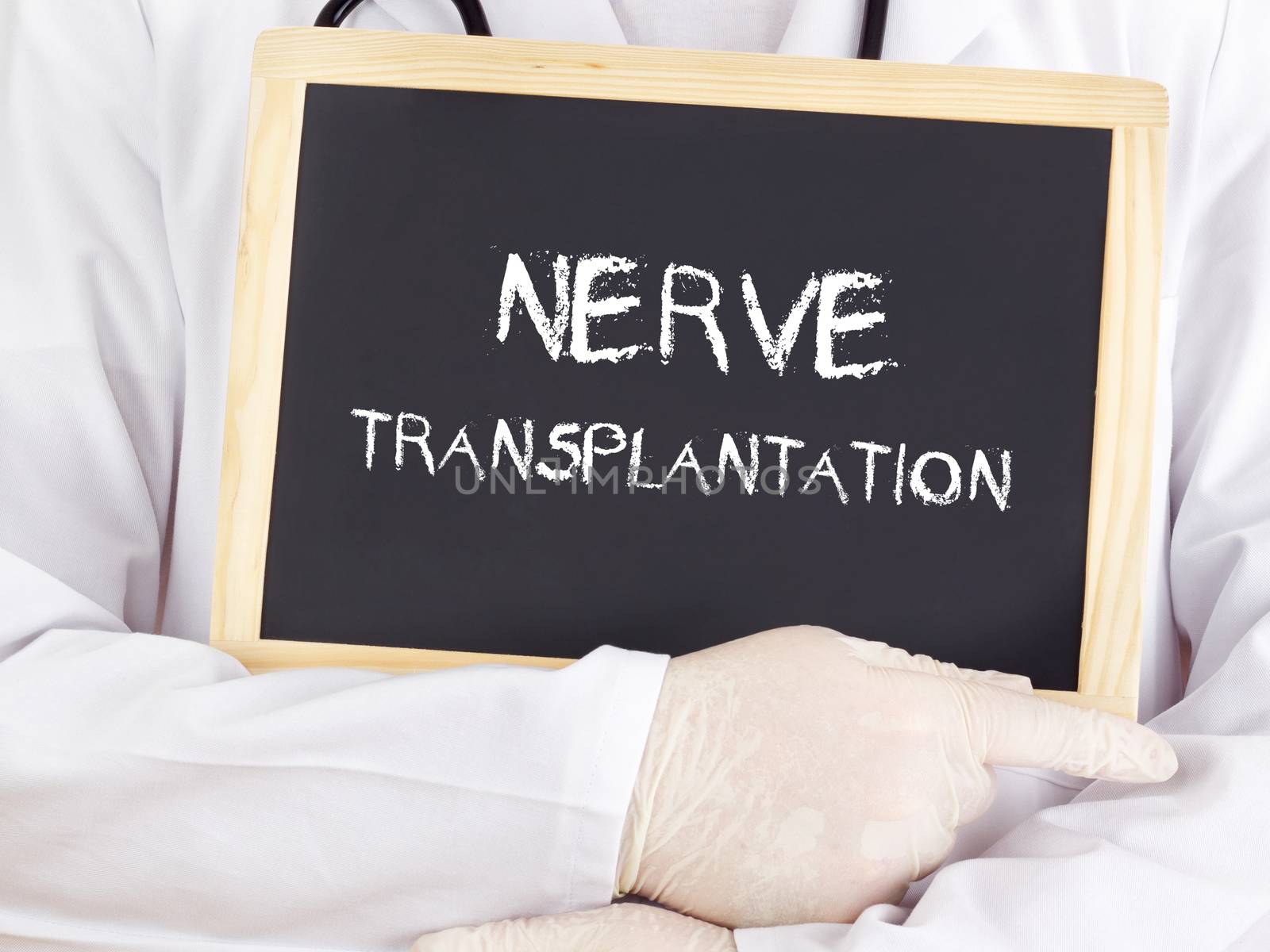 Doctor shows information: nerve transplantation