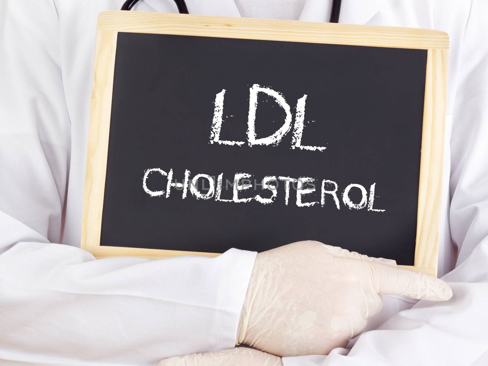 Doctor shows information: LDL cholesterol