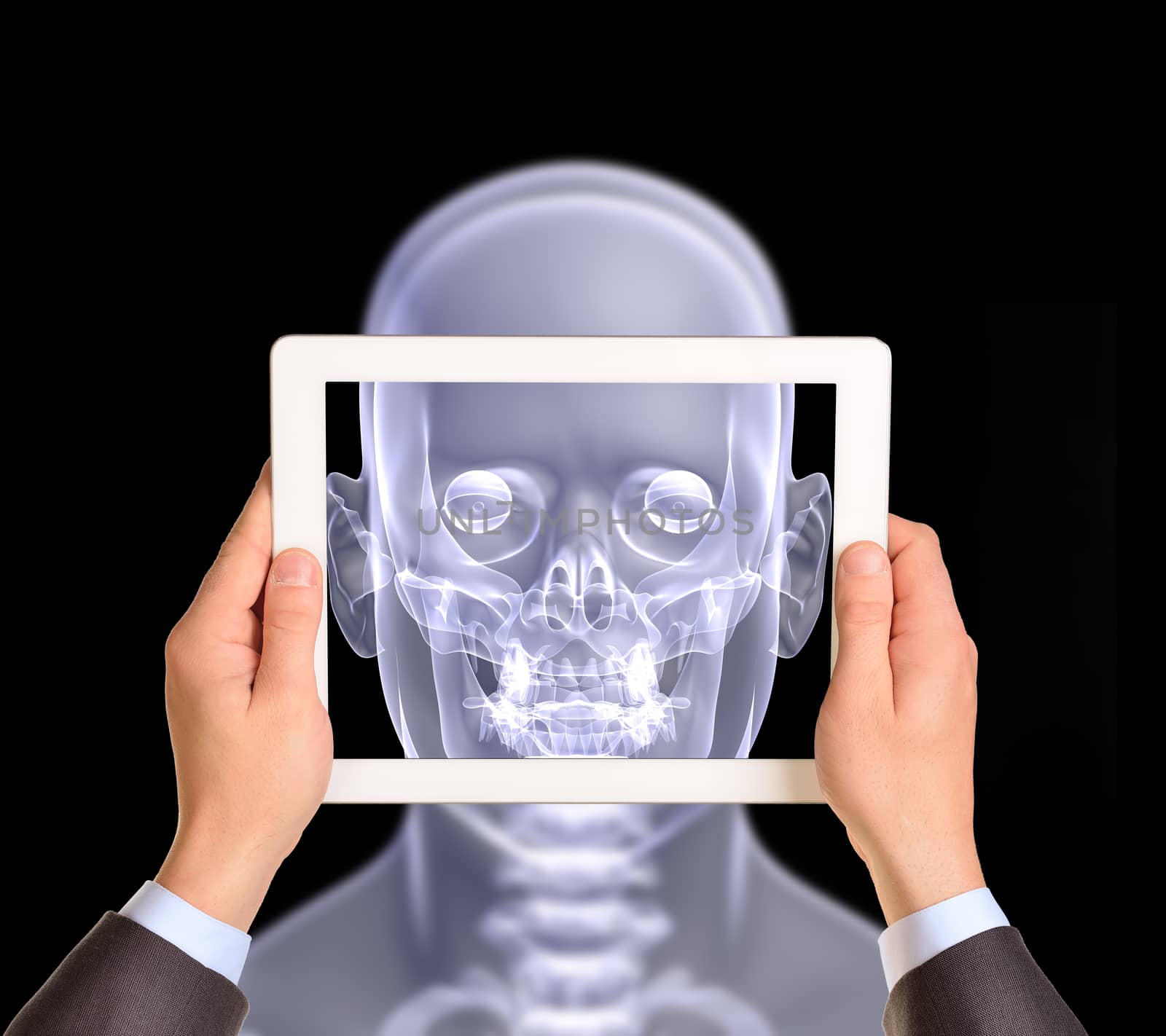 Man hands using tablet pc. Image of x-ray head on screen by cherezoff