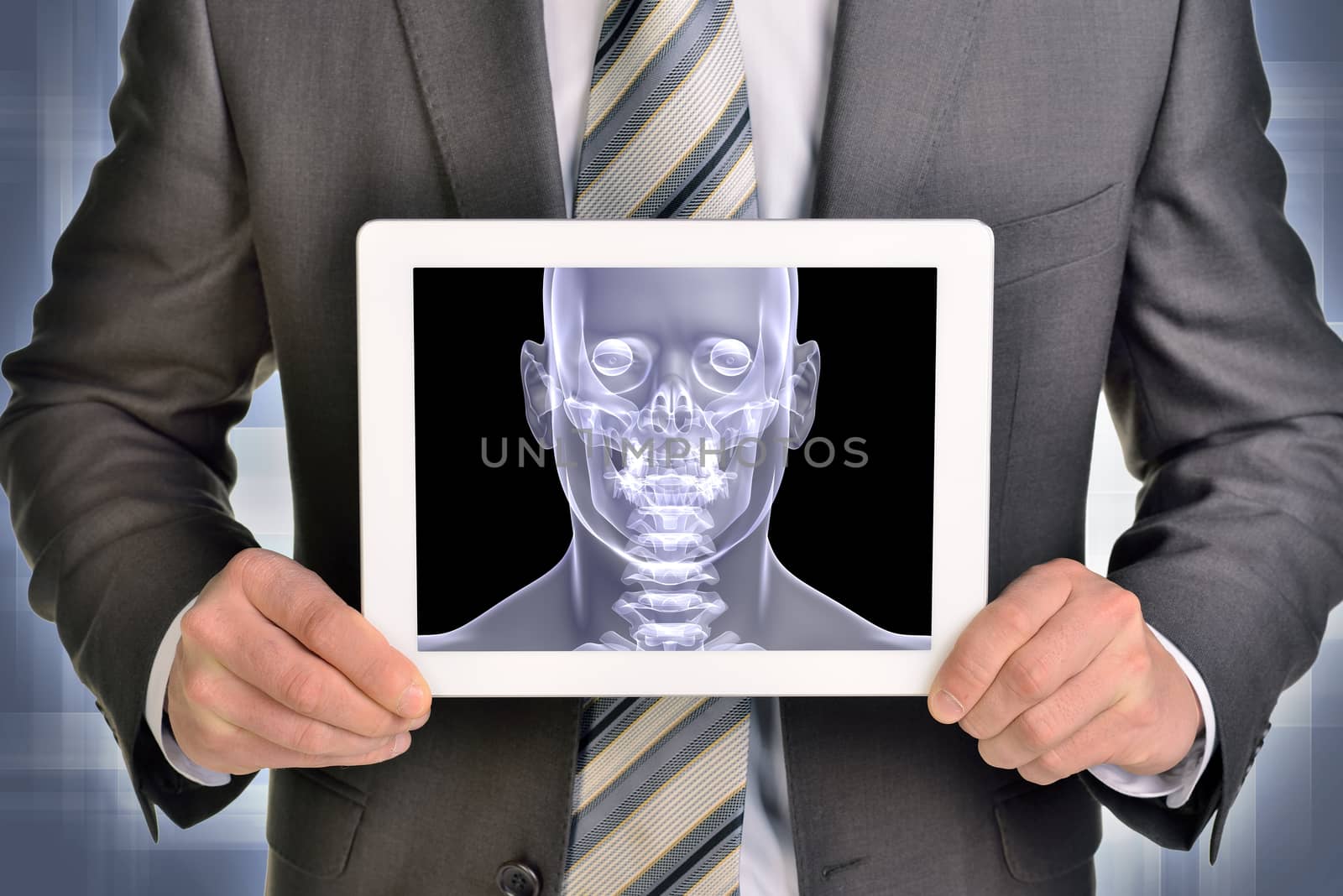 Man hands using tablet pc. Image of x-ray head on screen by cherezoff