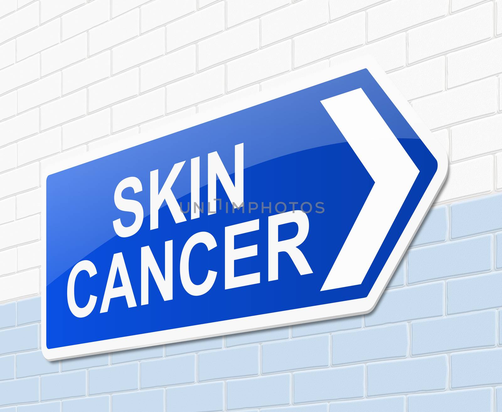 Illustration depicting a sign with a skin cancer concept.