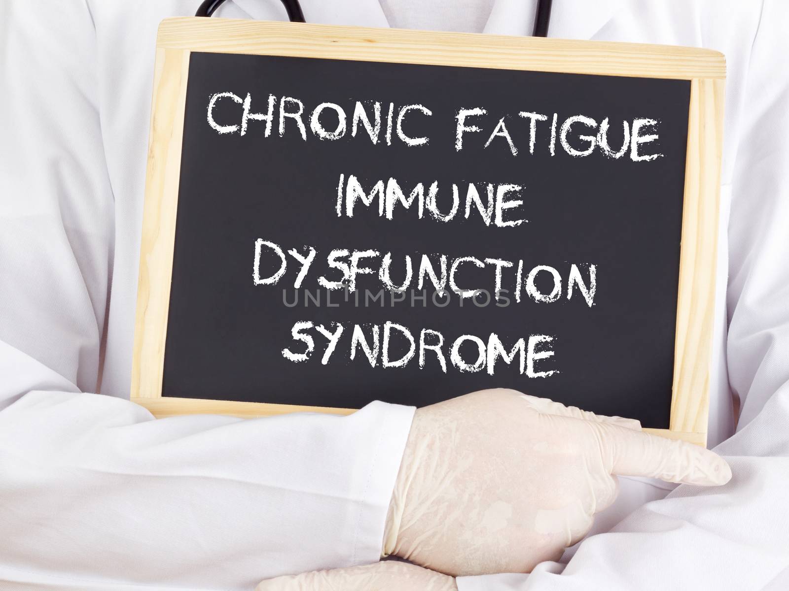 Doctor shows information: chronic fatigue syndrome immune dysfunction syndrome