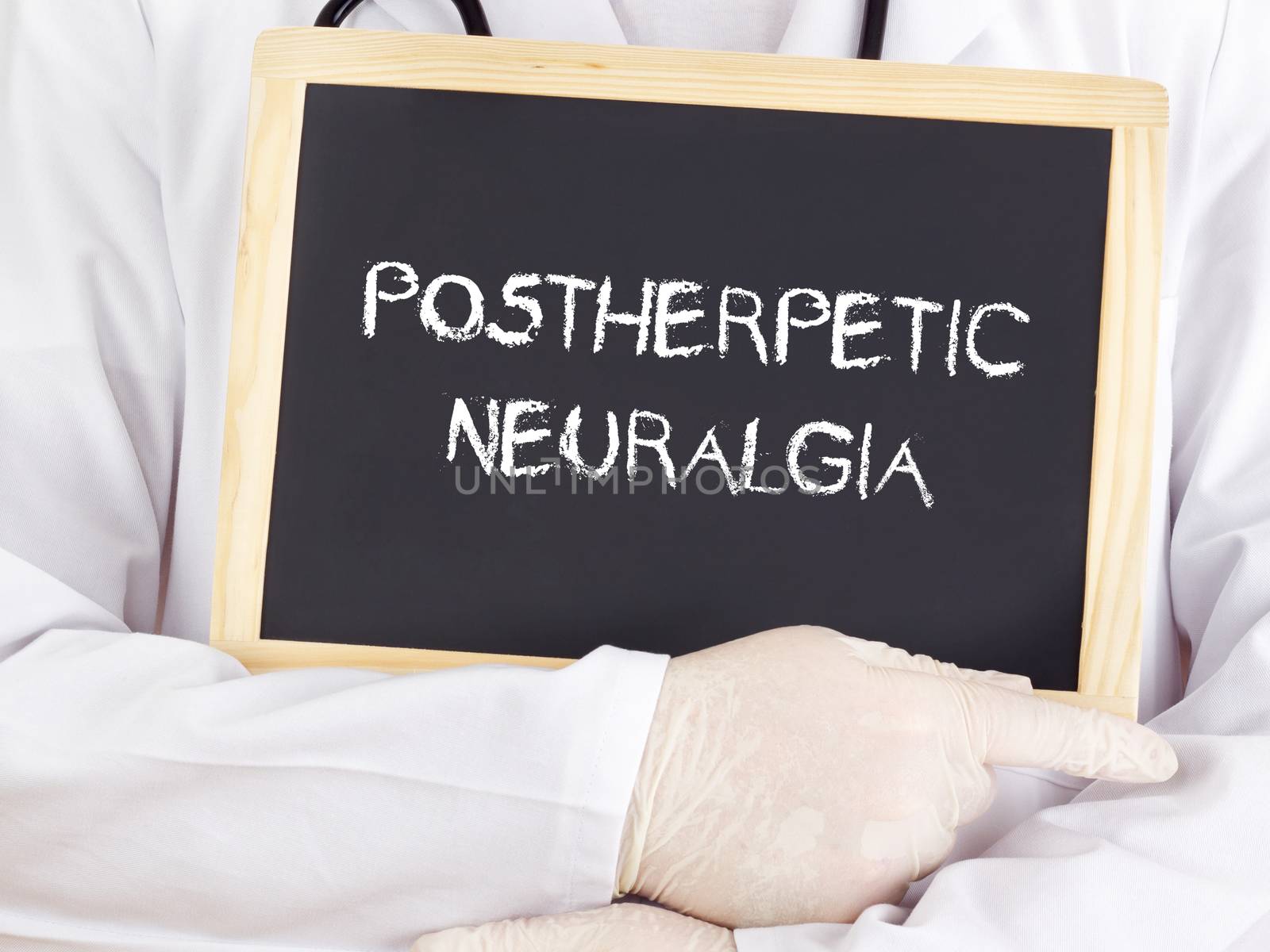 Doctor shows information: postherpetic neuralgia