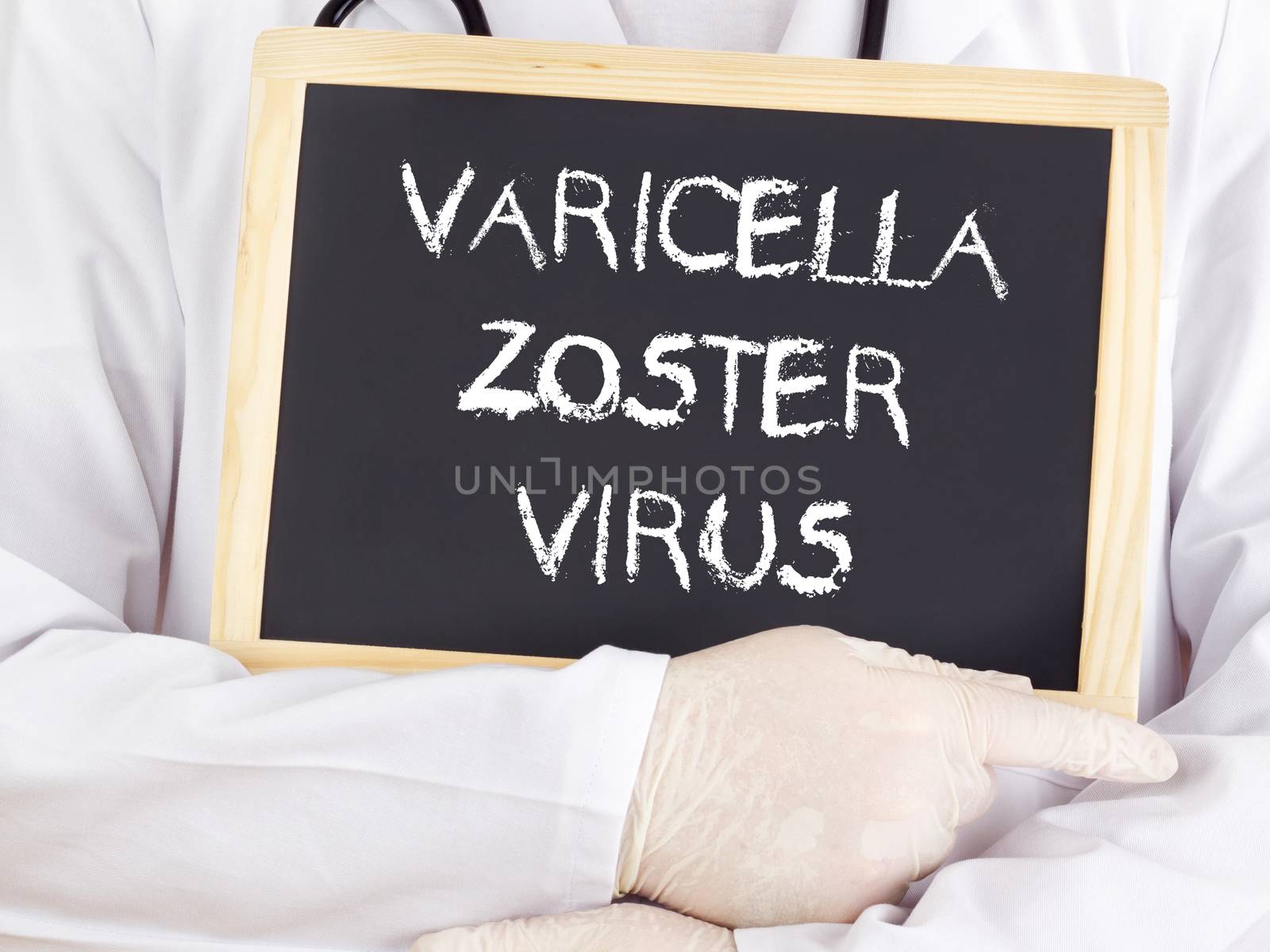 Doctor shows information: varicella zoster virus