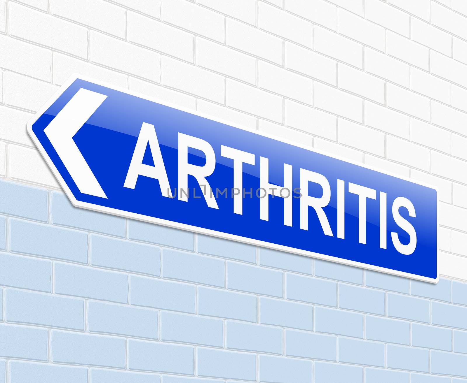 Illustration depicting a sign with an arthritis concept.